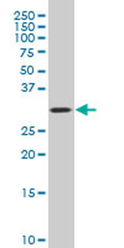 COPE polyclonal antibody (A01)