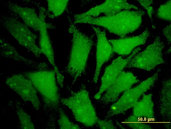 MGAT4B monoclonal antibody (M01), clone 1F4