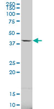 CA5B polyclonal antibody (A01)
