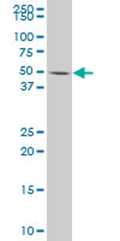DUSP10 polyclonal antibody (A01)