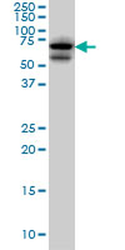 AKAP10 monoclonal antibody (M04), clone 8C10
