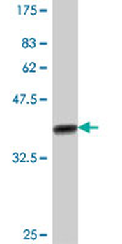 AKAP11 polyclonal antibody (A01)