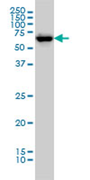 CHEK2 monoclonal antibody (M01), clone 4B7
