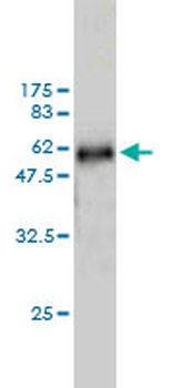 WDR6 monoclonal antibody (M01), clone 2D4