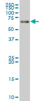 LZTS1 polyclonal antibody (A01)