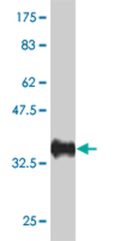 BAZ1A monoclonal antibody (M01), clone 1F6