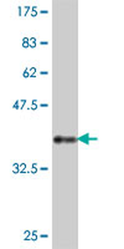 PTP4A3 polyclonal antibody (A01)