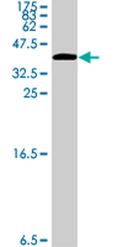 CIT polyclonal antibody (A01)
