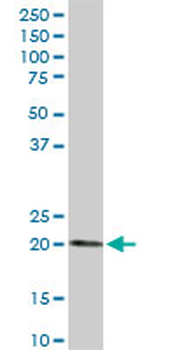 ESM1 MaxPab rabbit polyclonal antibody (D01)