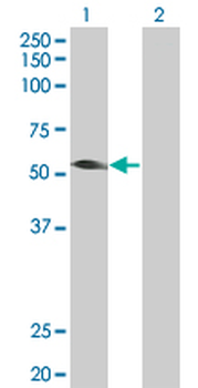 TRIM31 MaxPab mouse polyclonal antibody (B01)