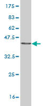 CPSF6 monoclonal antibody (M10), clone 3F11