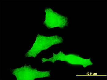 RAB31 monoclonal antibody (M03), clone 4D12
