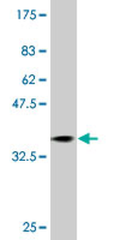 RAB31 monoclonal antibody (M01), clone 1C6