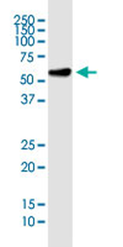 RNPS1 monoclonal antibody (M05), clone 7G8