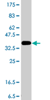 ALDH1L1 polyclonal antibody (A01)