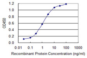 SEPT9 monoclonal antibody (M01), clone 2C6