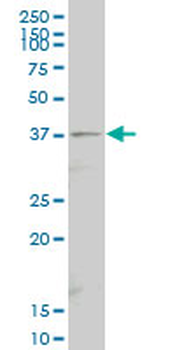 SEPT9 polyclonal antibody (A01)
