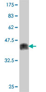 ZNF274 polyclonal antibody (A01)