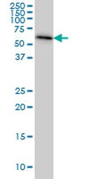 AHCYL1 monoclonal antibody (M05), clone 5D6