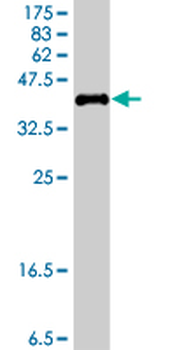 KDM5B polyclonal antibody (A01)