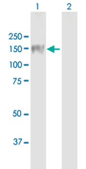 PLK4 MaxPab mouse polyclonal antibody (B01)