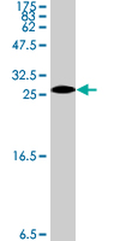 LASS1 polyclonal antibody (A01)