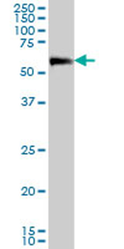 CAMKK2 monoclonal antibody (M02), clone 4C7