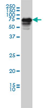 CAMKK2 monoclonal antibody (M01), clone 1A11
