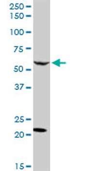 CAMKK2 MaxPab rabbit polyclonal antibody (D01)