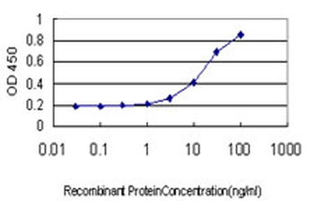 PDLIM5 monoclonal antibody (M01), clone 3E11-F6