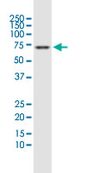 PDLIM5 polyclonal antibody (A02)