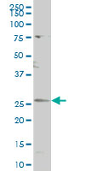 CDC42EP3 polyclonal antibody (A01)