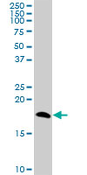 NPC2 purified MaxPab mouse polyclonal antibody (B01P)