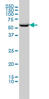 CCT2 monoclonal antibody (M01), clone 2G6