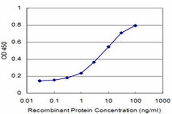 CCT7 monoclonal antibody (M02), clone 3A6