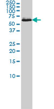 CCT7 monoclonal antibody (M01), clone 1D6