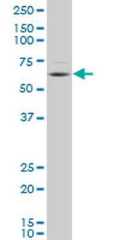 DPYSL4 polyclonal antibody (A01)