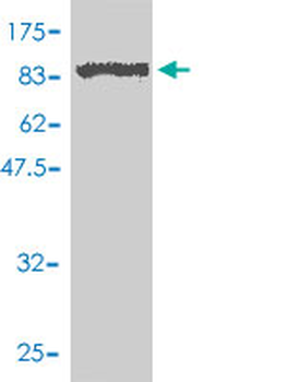 SLU7 polyclonal antibody (A01)
