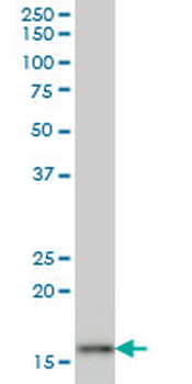 AGR2 monoclonal antibody (M03), clone 1C3