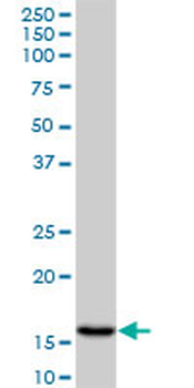 AGR2 monoclonal antibody (M01), clone 1E5