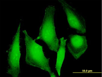 UBD purified MaxPab mouse polyclonal antibody (B01P)