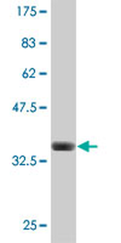 APPBP2 polyclonal antibody (A01)