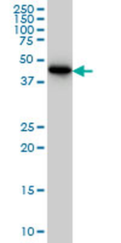CRTAP monoclonal antibody (M01), clone 4D9