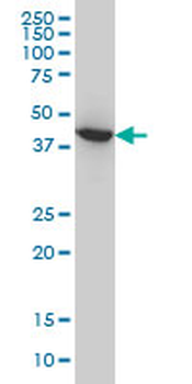 ACAA2 monoclonal antibody (M01), clone 5C4