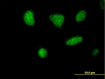 MCRS1 purified MaxPab mouse polyclonal antibody (B01P)