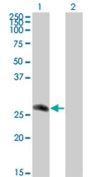 CDC42EP2 monoclonal antibody (M01), clone 2H7