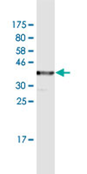 TCIRG1 monoclonal antibody (M02), clone 7H20