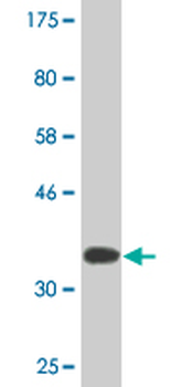 TCIRG1 monoclonal antibody (M01A), clone 6H3