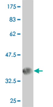 TCIRG1 monoclonal antibody (M01), clone 6H3