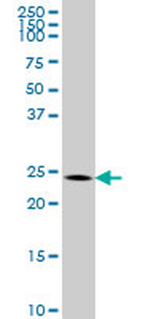 BCAS2 monoclonal antibody (M01), clone 1D10
